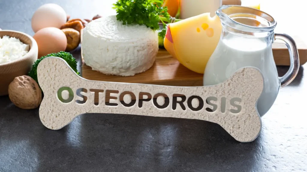 Nutricionista especialista em osteoporose